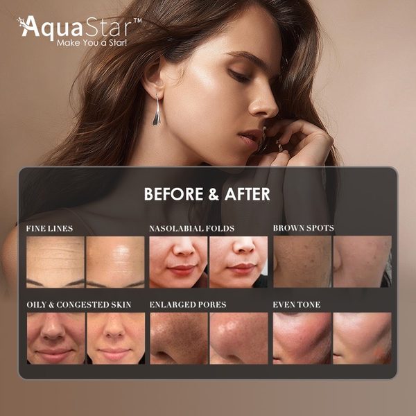 Hydrafacial
